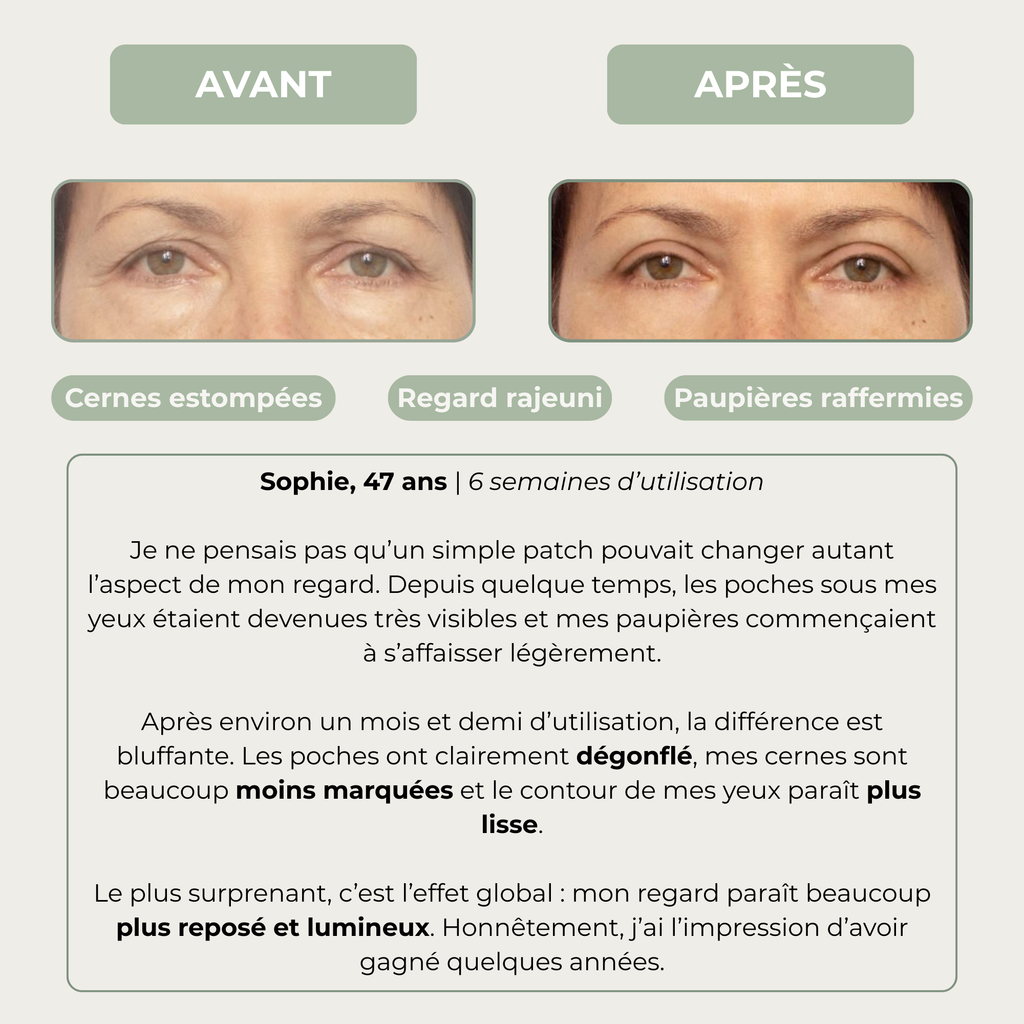 PATCHS REGARD 360° — EFFET RÉVEIL IMMÉDIAT