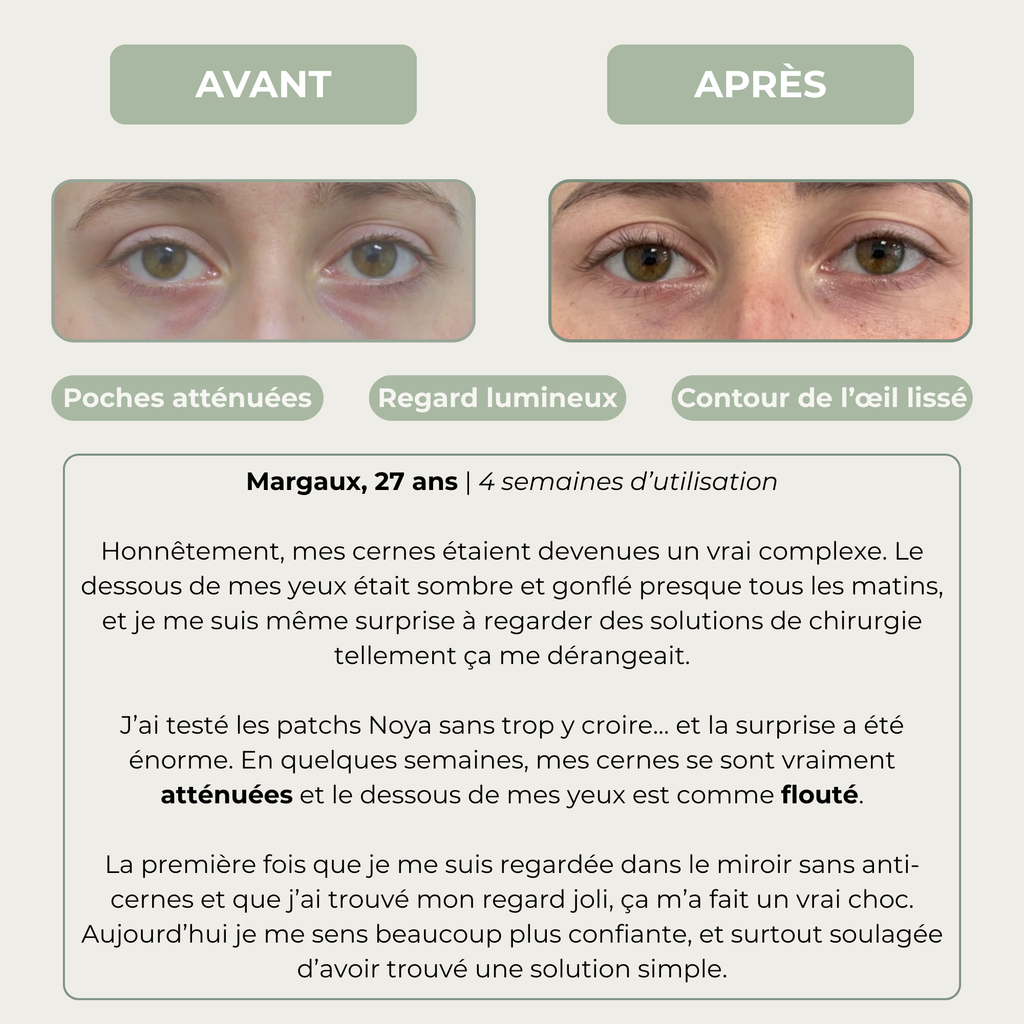PATCHS REGARD 360° — EFFET RÉVEIL IMMÉDIAT