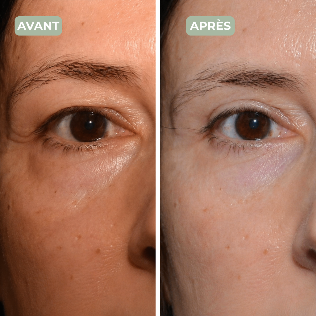 PATCHS REGARD 360°