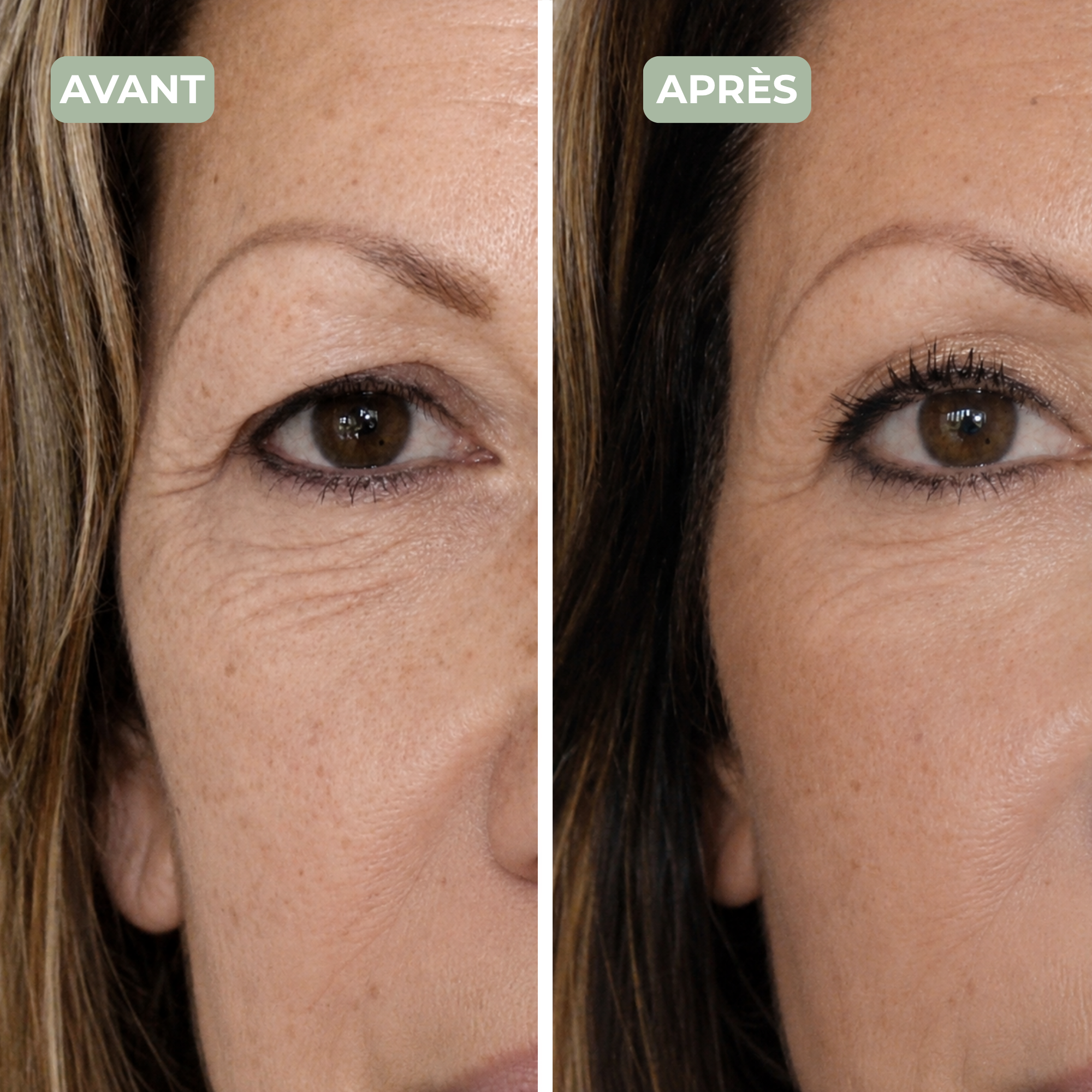 PATCHS REGARD 360°